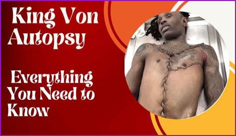 The Truth Unveiled: Autopsy Reveals Hidden Details Of King Von's Tragic Death